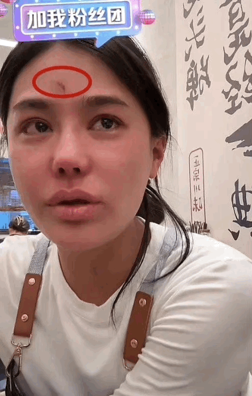 樊小慧儿虐孩子，森林北掉代言？  第3张