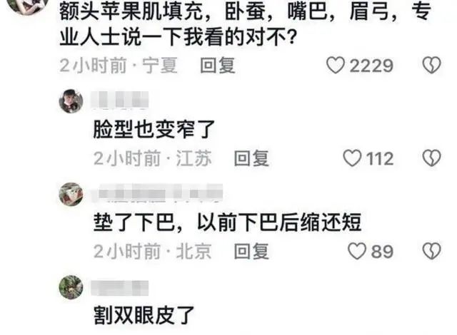 海清这是整失败了？不标名字根本认不出，女星集体动脸审美大倒退！  第7张