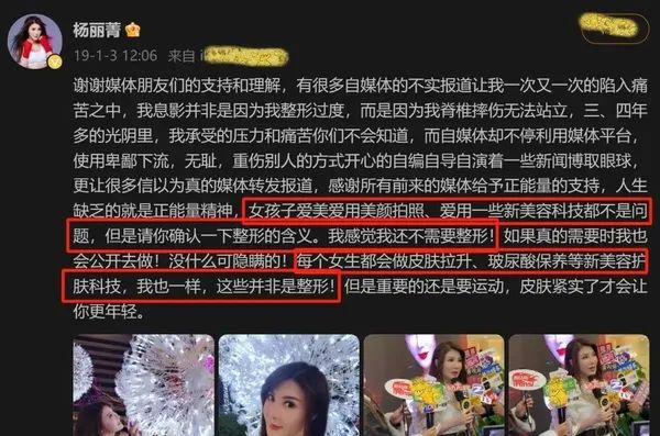 55岁功夫女神复出拍戏，“科技脸”又僵又肿，今昔对比判若两人