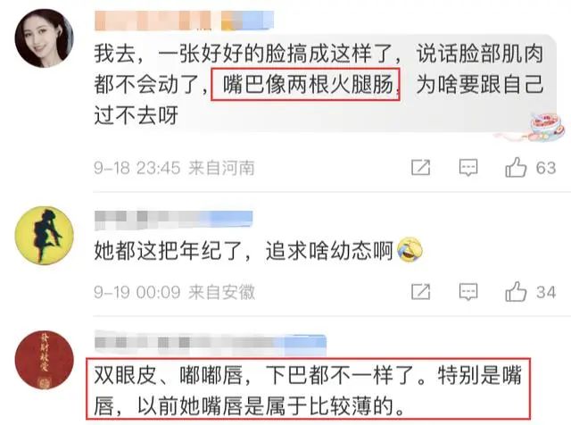 海清这是整失败了？不标名字根本认不出，女星集体动脸审美大倒退！  第5张